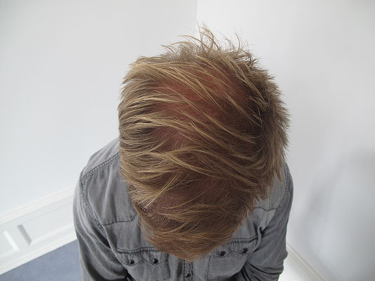 Case 1 - Før