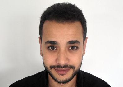 Younes - Hårtransplantation resultat 2