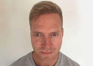 Frank - Efter behandlingen